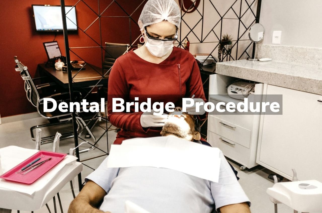 Dental Bridge Procedure