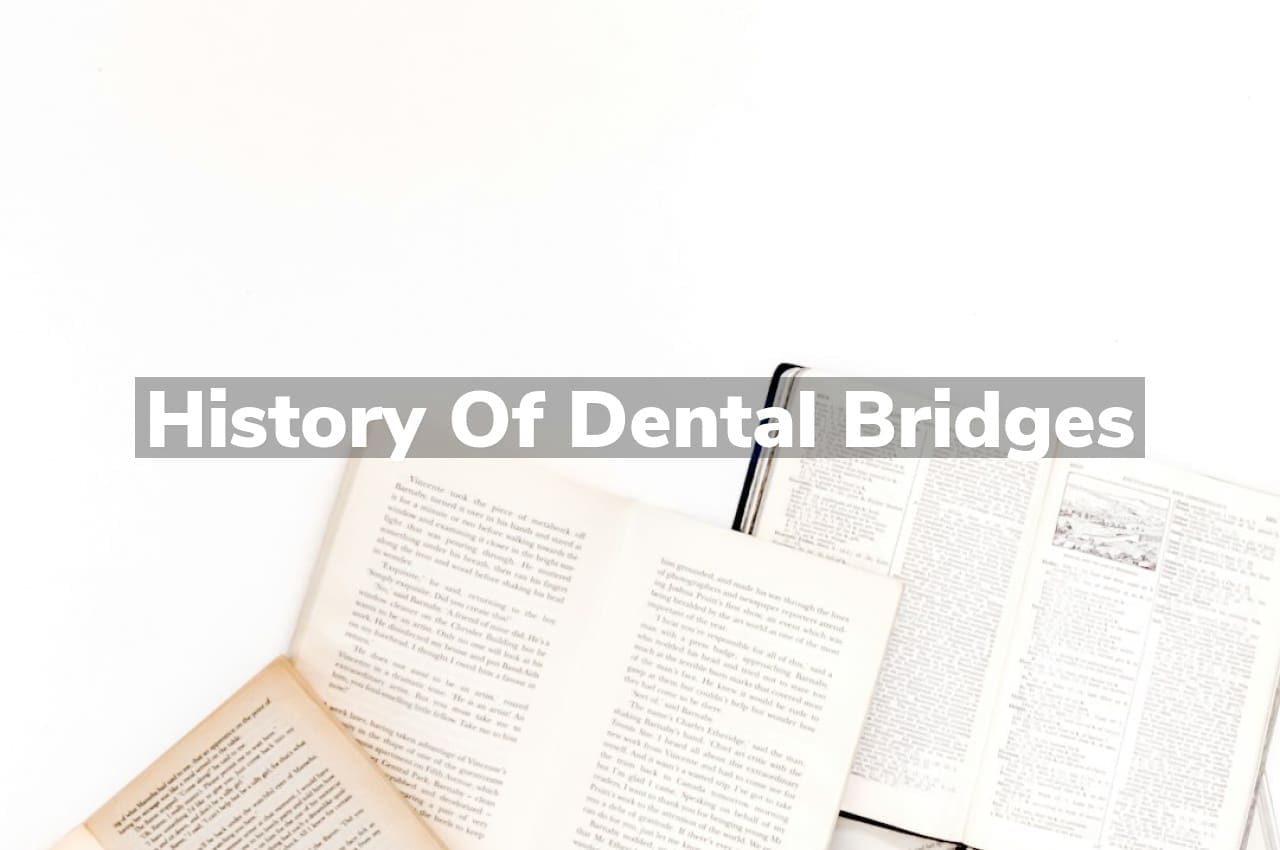 History of Dental Bridges