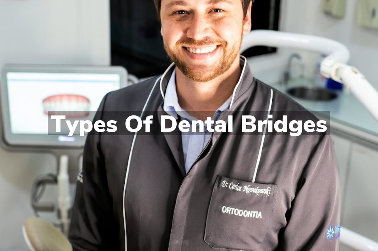 Types of Dental Bridges