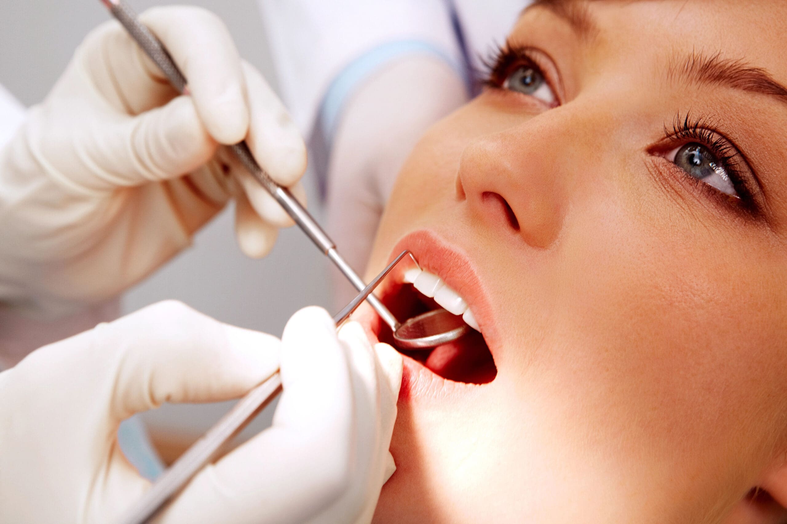 Cost Of Fillings: Understanding the Price of Tooth Repair