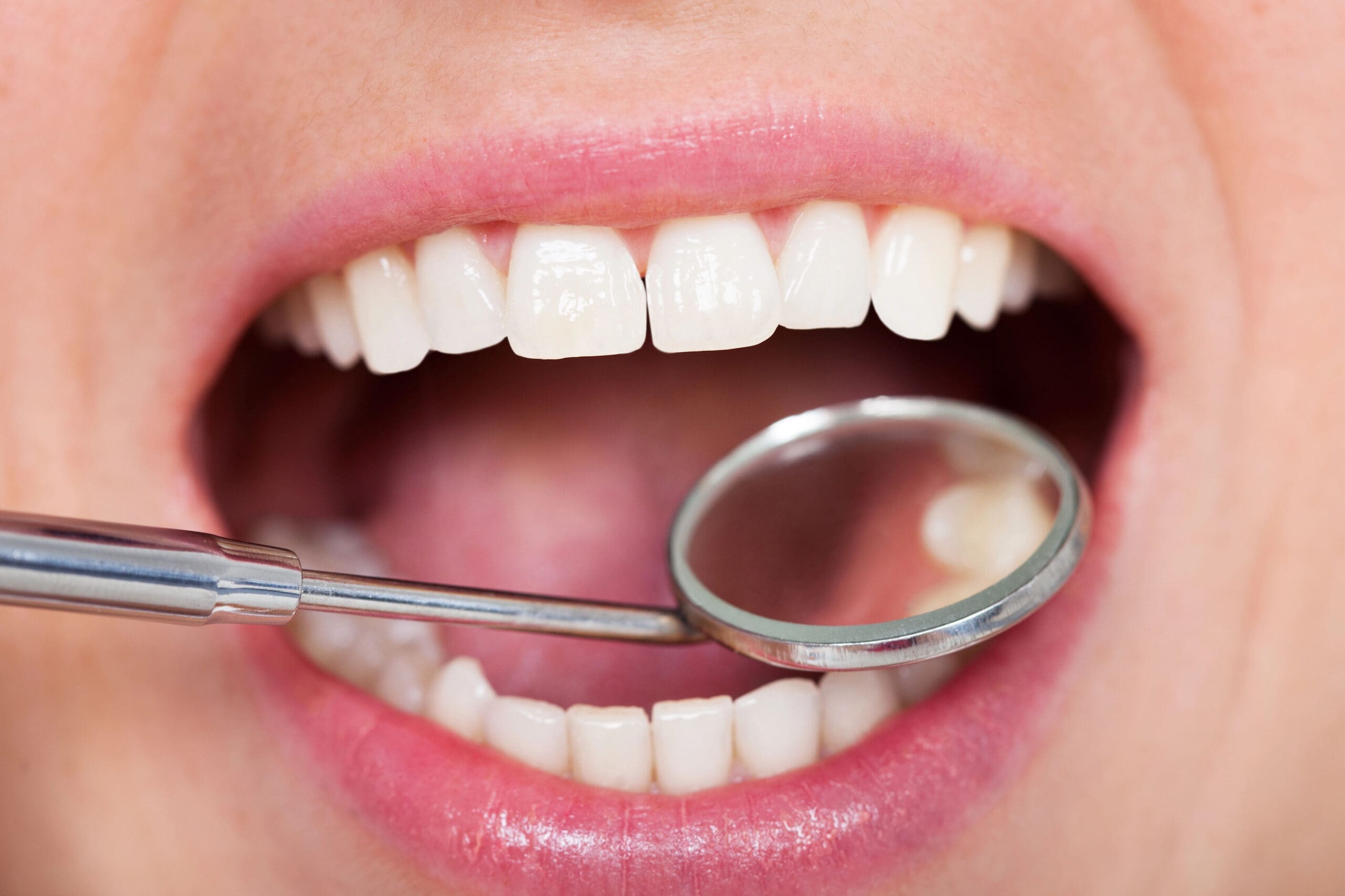 Temporary Tooth Filling: Quick Fix for Tooth Damage